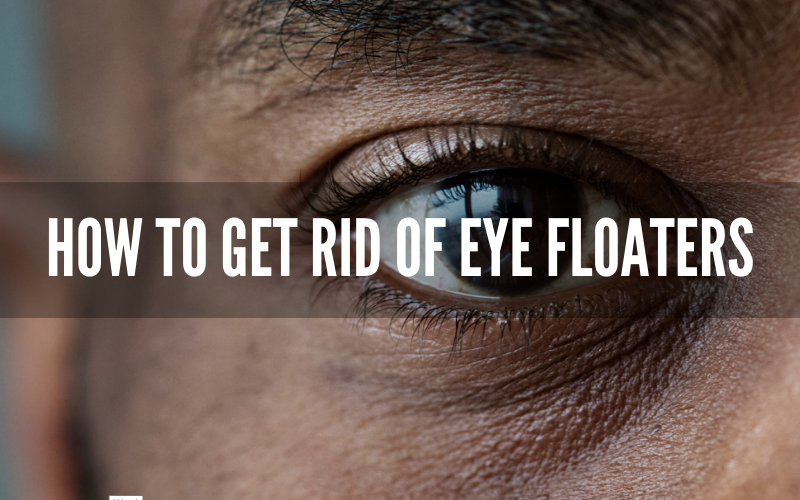 How to Get Rid of Eye Floaters – A Complete Guide