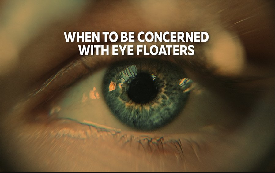 eye floaters ` How to get rid of eye floaters