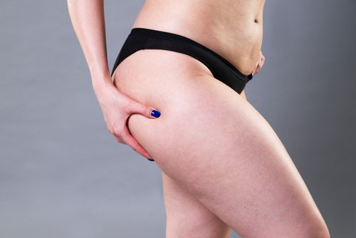 lower body fat to get rid of hip dips